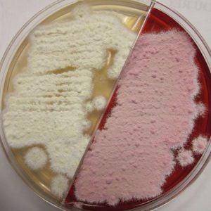 The colonies are fluffy white on the yellow side of the plate without phenol red. The colonies are pinkish-white on the opposite side of the plate where the phenol red has turned the media to a red color indicating dermatophyte growth.