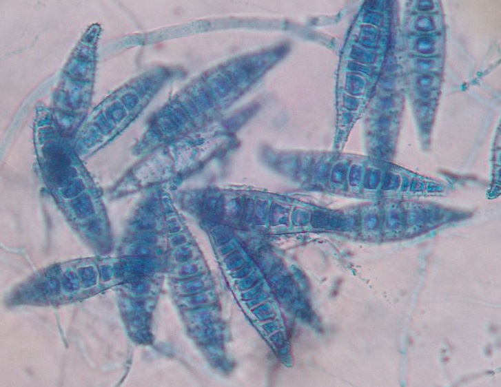 Microscopic exam of a Scotch tape prep from a suspect dermatophyte colony. The large blue-stained macroconidia with more than 6 cells indicate M. canis.