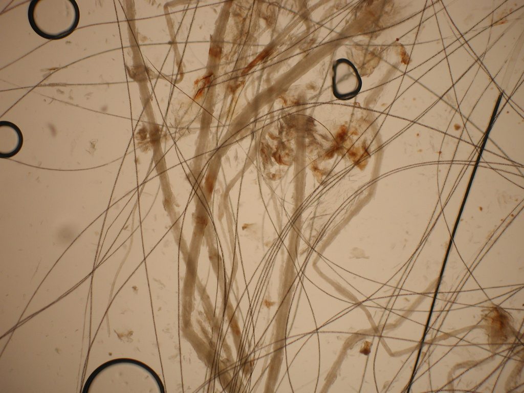 Microscopic exam of plucked hairs in a drop of mineral oil using the 10X objective. Normal hairs are black and thin, while M. canis -infected hairs are brown and thick with cuffs of fungal spores adhered to the shafts (ectothrix).